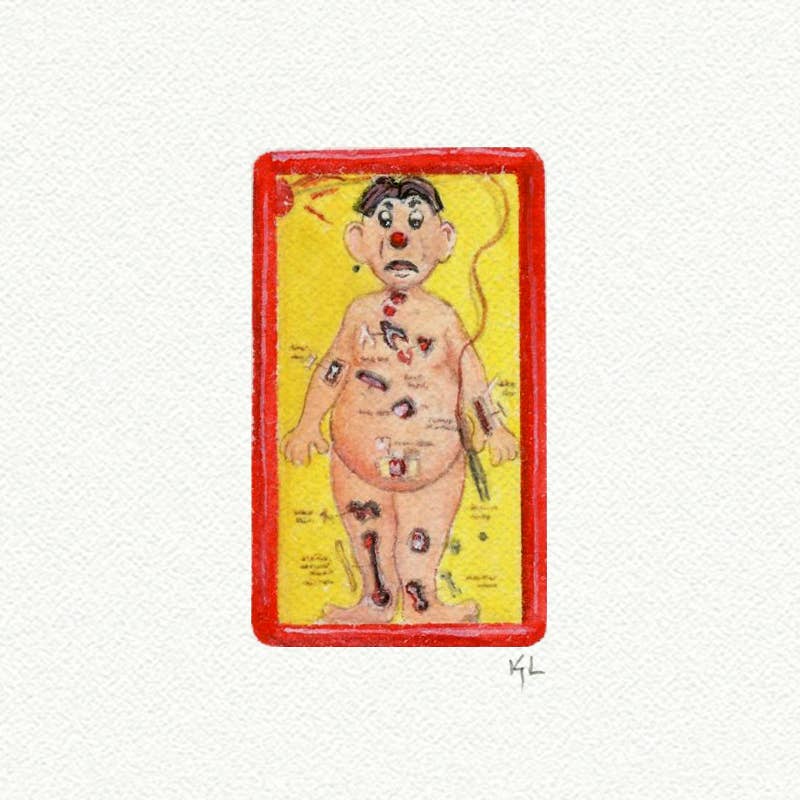 Miniature watercolor art print of Operation board game – unique gift for vintage game lovers
